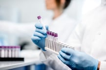 Blood-tubes-in-rack-1024x683